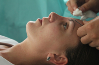 Ринопластика у Александра Гуляева