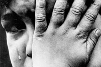 Травмировали нос при рождении