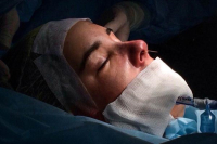 Пациентка пластического хирурга Глеба Тумакова