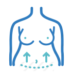 Абдоминопластика (пластика живота)