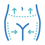 Липосакция