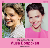Лиза Боярская сделала ринопластику у Артура Рыбакина