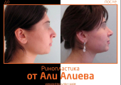 Aliev_rino_3