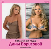 plastika_Dany_Borisovoy