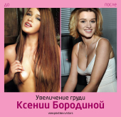 Ксения Бородина до и после увеличения груди