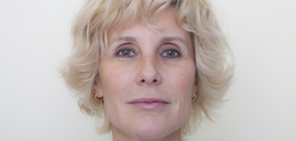 Пациентка после контурной пластики лица