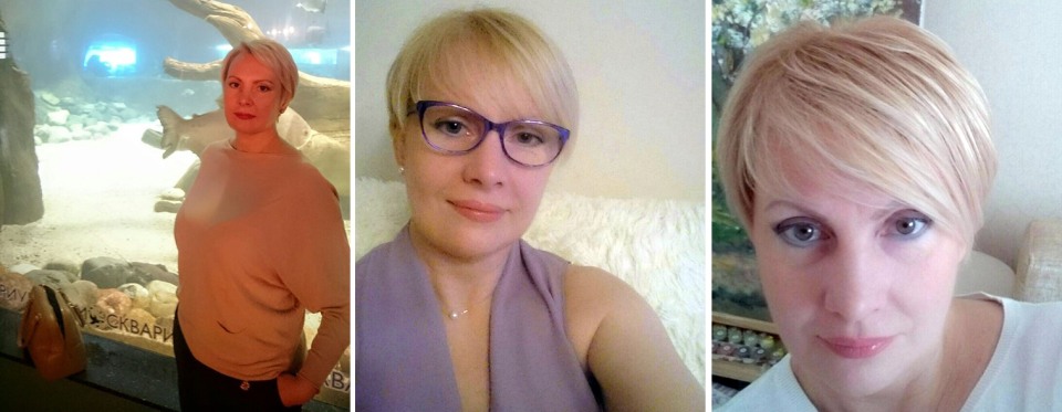 Фото после подтяжки нитями и блефаропластики