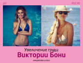 Виктория Боня до и после увеличения груди