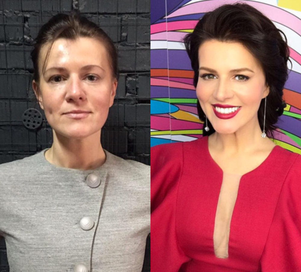 Юлия до и после преображения в клинике профессора Блохина