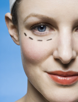 Трансконъюктивальная блефаропластика