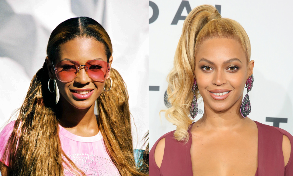 Бейонсе до и после пластики подбородка