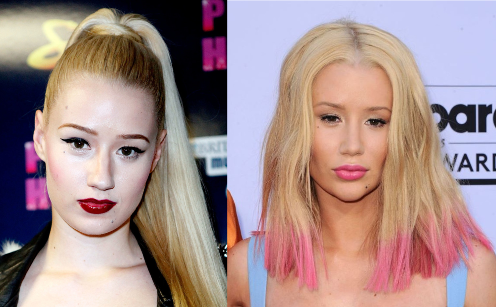 Игги Азалия до и после пластики подбородка