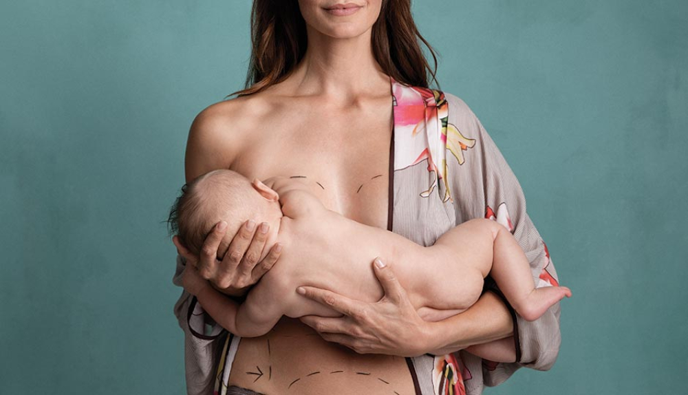 импланты и грудное вскармливание