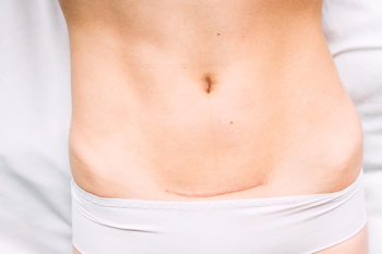 Процесс заживления раны занимает примерно год