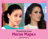Меган Маркл до и после ринопластики