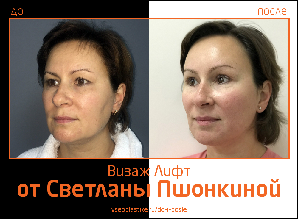 Визаж Лифт фото до и после