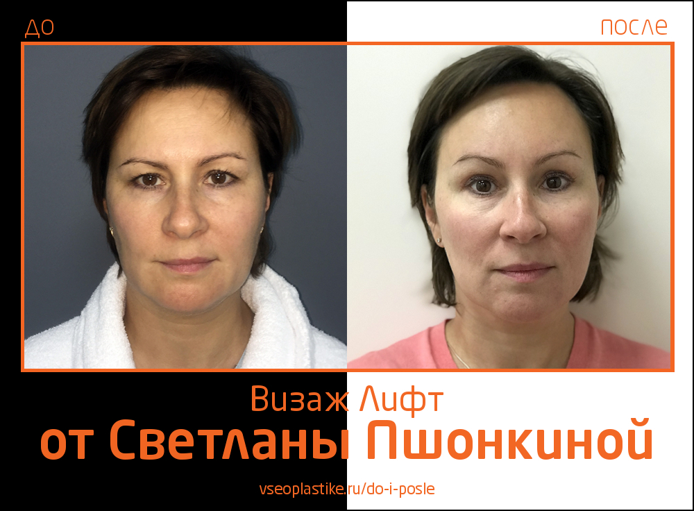 Визаж Лифт фото до и после