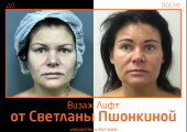 Светлана Пшонкина. Фото до и после подтяжки Визаж Лифт