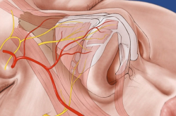 Пластика кончика носа