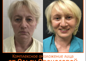 Ольга Ованесова. Фото до и после комплексного омоложения лица
