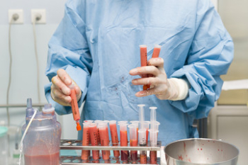 Липофилинг голеней