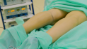 Во время круропластики пациент лежит на животе