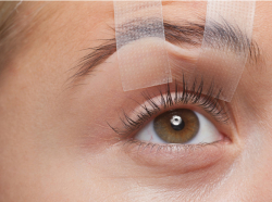 Чего ожидать от блефаропластики?