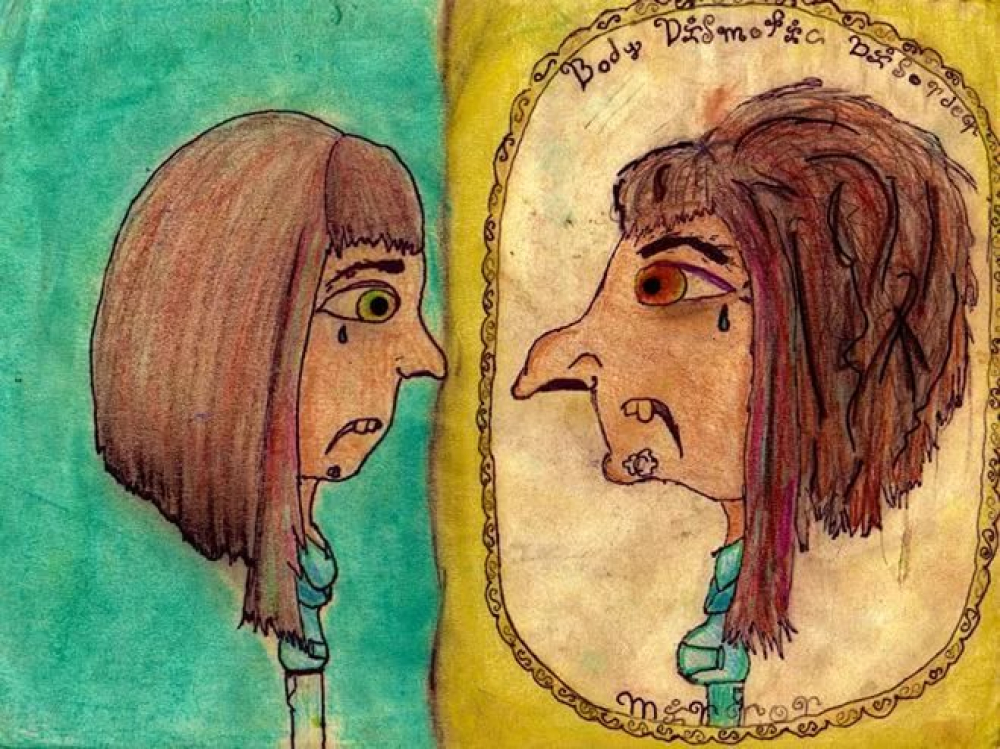 Как живут люди с дисморфофобией