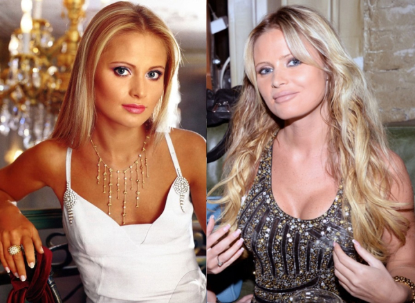 Дана Борисова до и после увеличения груди