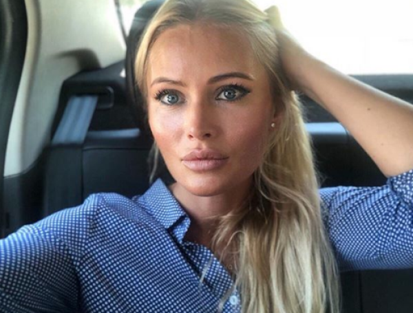 Дана Борисова после увеличения губ