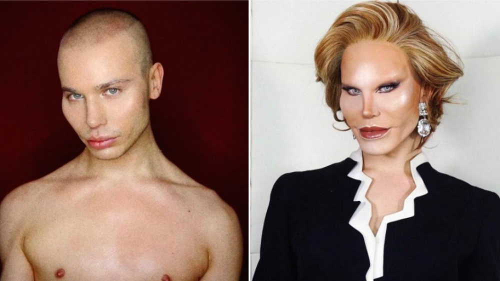 Звезда Инстаграма прожил 3 месяца, притворяясь, что сделал пластику