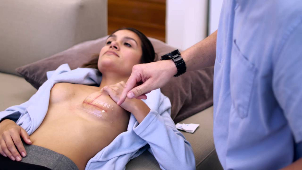 Келоидный рубец