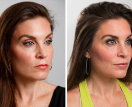 Женщина выглядела настолько недовольной, что решилась на пластику