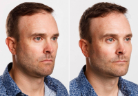 Муж «вечно недовольной» женщины сделал пластику лица