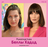Белла Хадид  до и после ринопластики