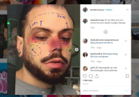 Инстаграм банит фильтры с пластической хирургией