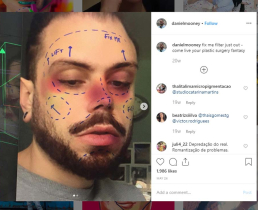 Инстаграм банит фильтры с пластической хирургией