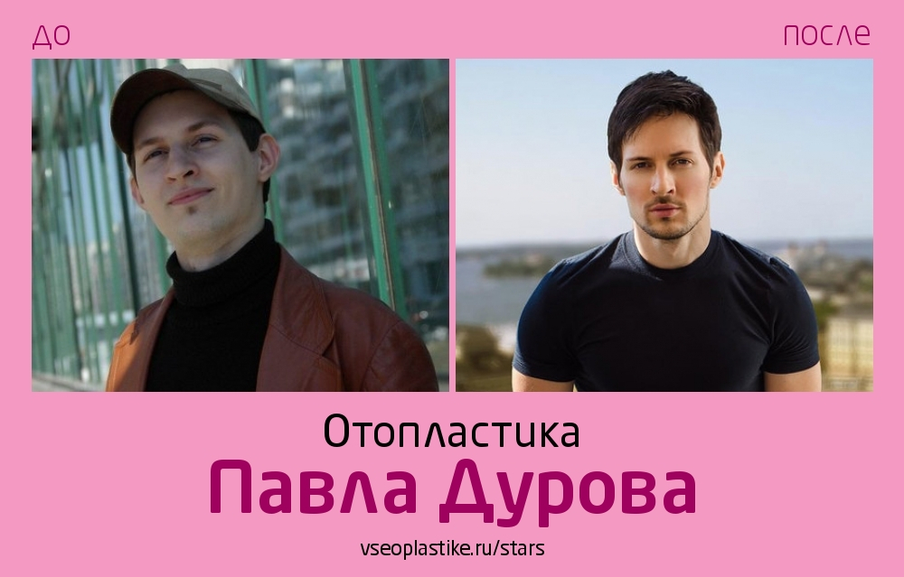 Павел Дуров уши до и после пластики