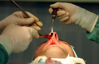 Почему проводят вторичную ринопластику