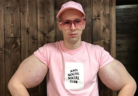 Кириллу Терешину удалили руки-базуки