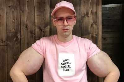 Кириллу Терешину удалили руки-базуки