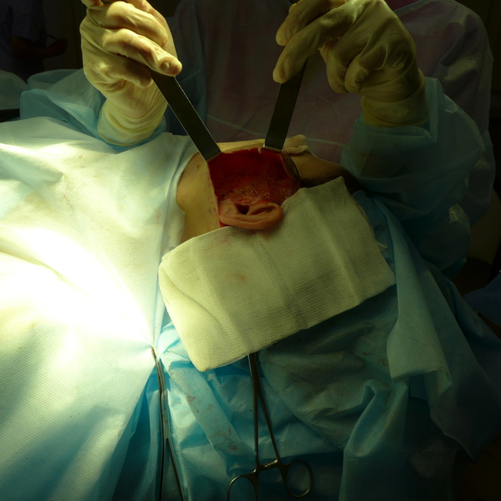 Аналогичные манипуляции с другой стороны лица