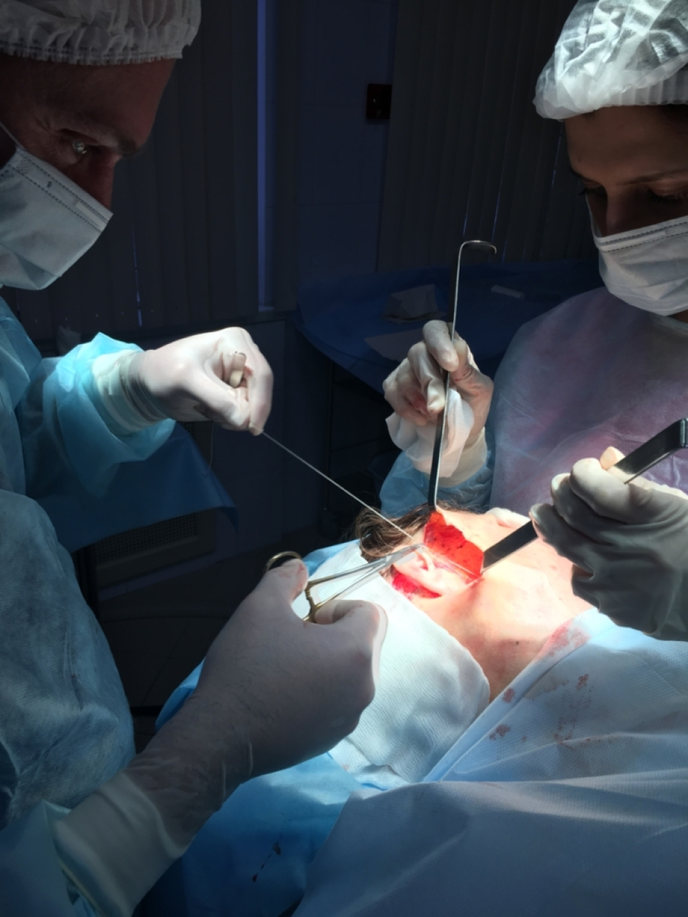 Ушивание Смас тканей и фиксация на новом месте после их подтяжки