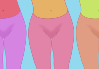 Делать лабиопластику или нет?