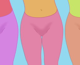 Делать лабиопластику или нет?