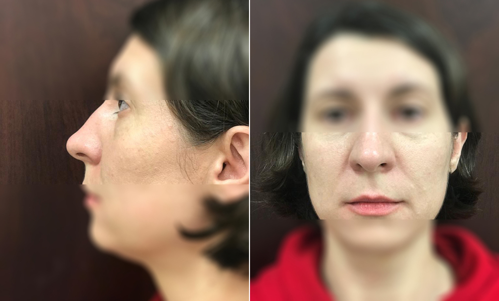 Визаж Лифт до и после