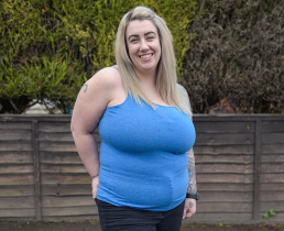 Чересчур большая грудь испортила жизнь британке