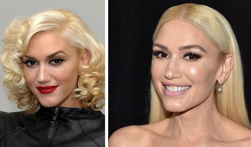 Гвен Стефани до и после предполагаемой пластики лица