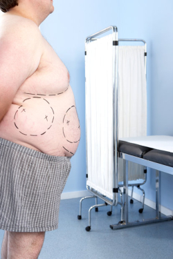 Пластические операции для мужчин