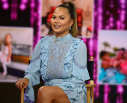 Пластические операции Крисси Тейген